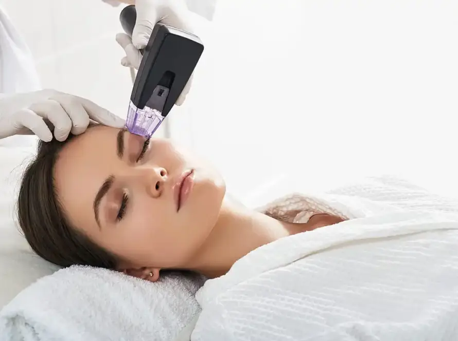 A client receiving a Morpheus8 RF microneedling skin tightening face treatment at Xthetics Med Spa.
