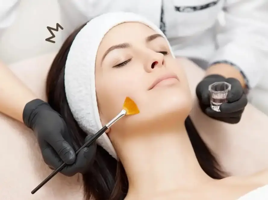A client receiving a professional cosmetic chemical peel facial treatment at Xthetics Med Spa.