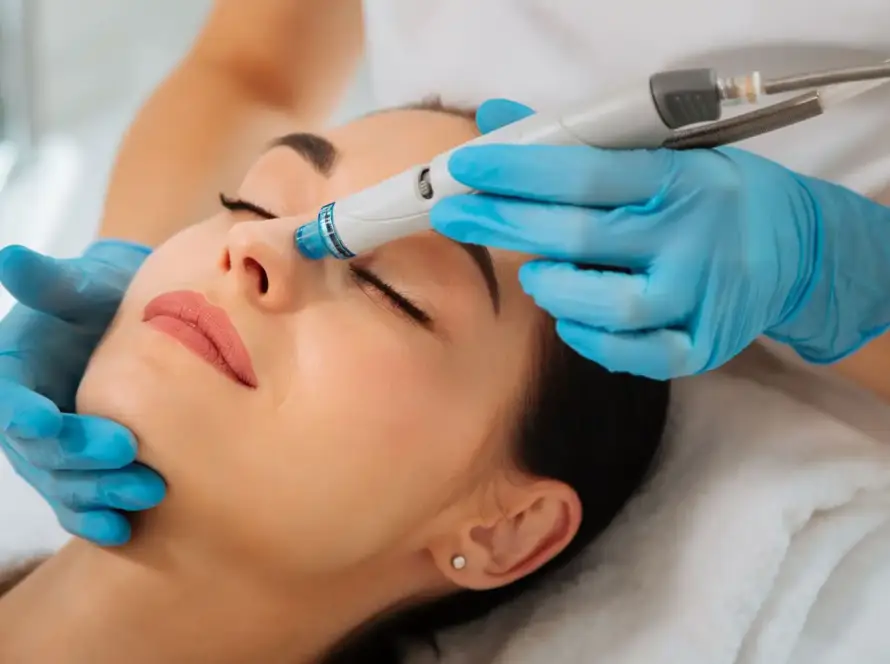 Client receiving a refreshing Hydrafacial skin treatment at Xthetics Med Spa.