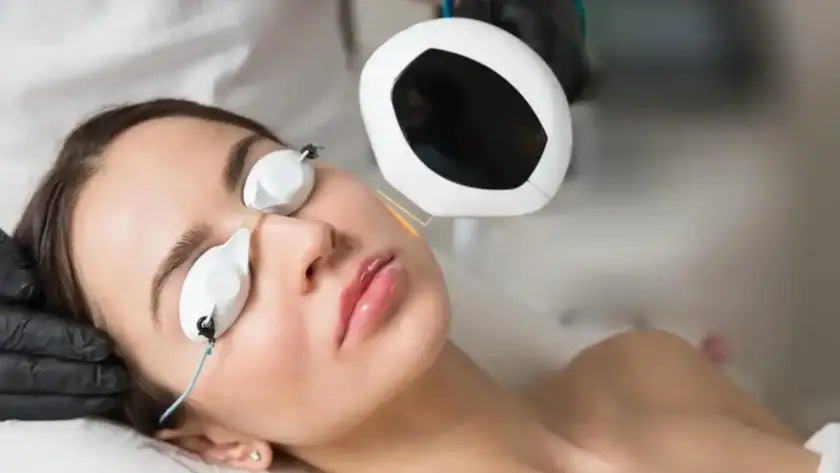 Client receiving a Lumecca IPL intense pulsed light treatment at Xthetics Med Spa.