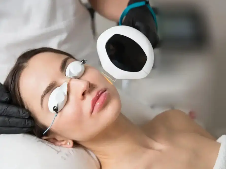 Client receiving a Lumecca IPL intense pulsed light treatment at Xthetics Med Spa.