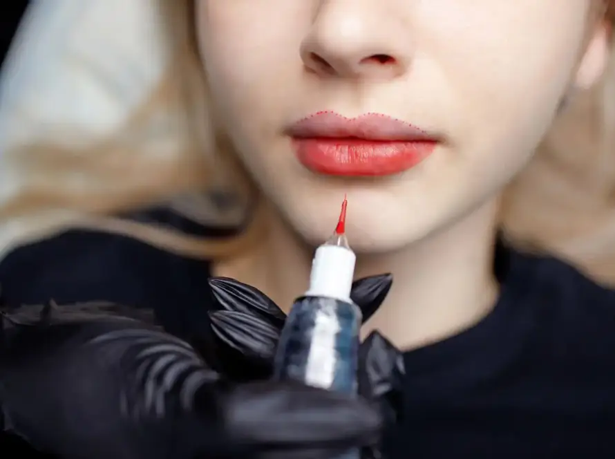 A close-up of a client receiving a permanent makeup lip blushing at Xthetics Med Spa.