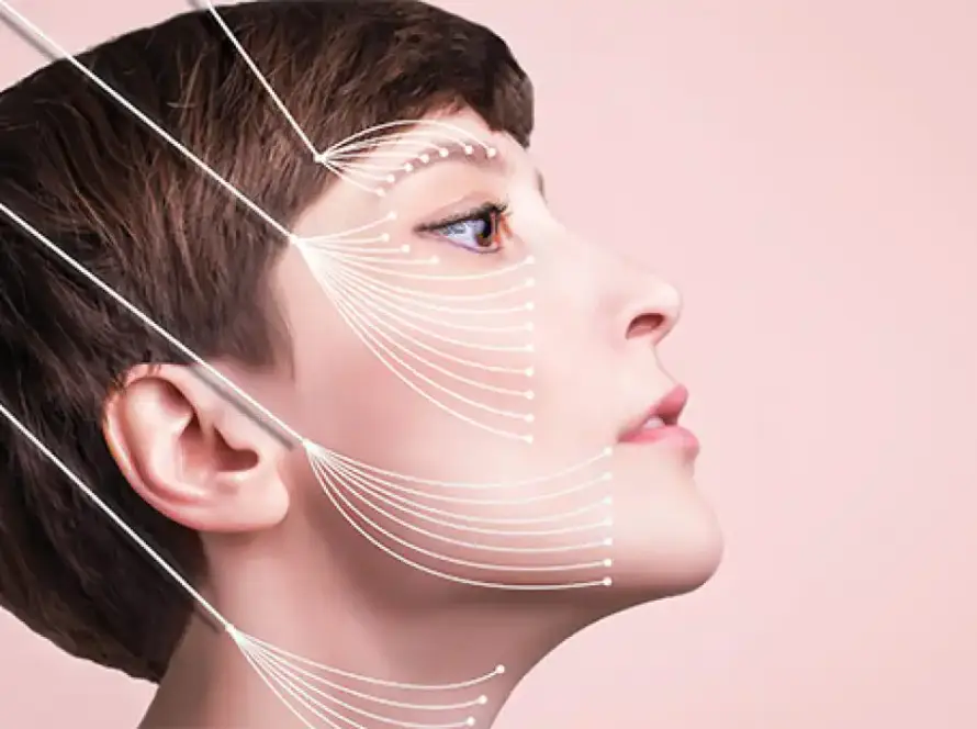 Side profile diagram showing non-surgical PDO Thread Lift vectors at Xthetics Med Spa.